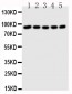 Anti-STAT1 Antibody